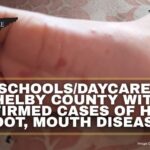 30+ Schools/Daycares In Shelby County With Confirmed Cases of Hand, Foot, Mouth Disease